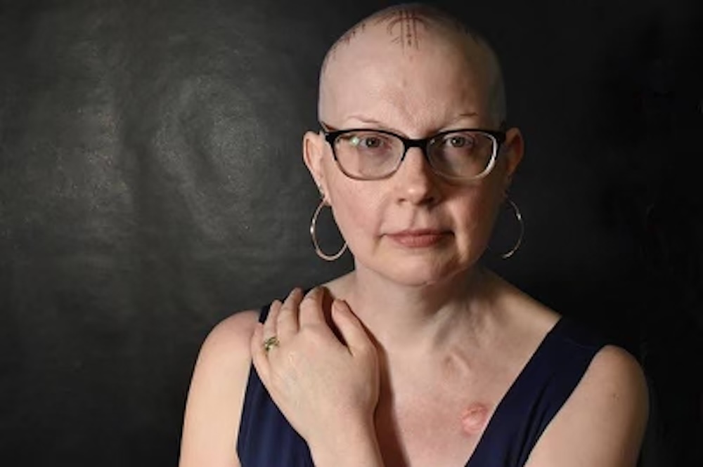 ‘I Was Diagnosed With Two Different Types of Breast Cancer at the Same Time (Yes, That Can Happen)’